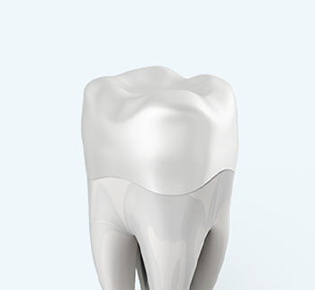 지르코니아 크라운